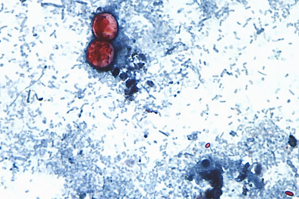 Two US Deaths Linked to Cyclospora Parasite Reported in Michigan - Image 1